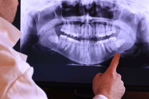 Best Cracked Tooth Emergency Dentist  in Burton, MI